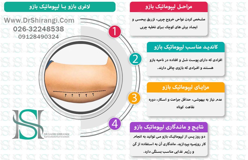 اینفوگرافی لیپوماتیک بازو