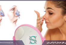 عمل رینوپلاستی