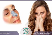 دستکاری بینی بعد از جراحی بینی