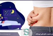 تاثیر خوابیدن بر روی عمل لیپوماتیک