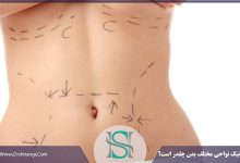 هزینه لیپوماتیک نواحی بدن چقدر است؟