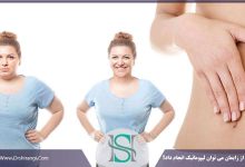 لیپوماتیک بعد از زایمان
