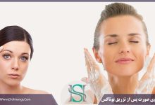 حمام بعد از بوتاکس