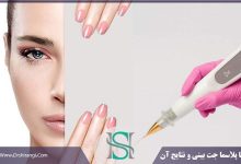 پلاسما جت بینی