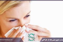 اهمیت شست و شو بینی بعد از عمل