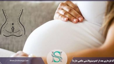 آیا بارداری بعد از ابدومینوپلاستی مانعی دارد؟