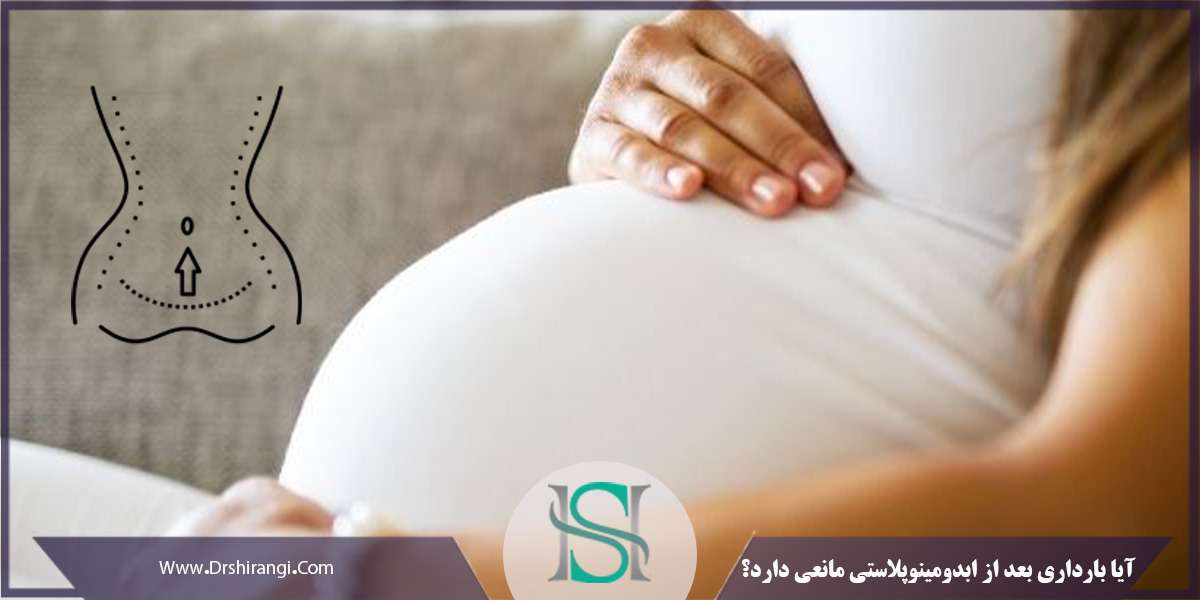 آیا بارداری بعد از ابدومینوپلاستی مانعی دارد؟