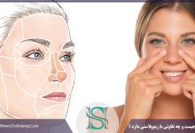 تیپ پلاستی یا جراحی بینی