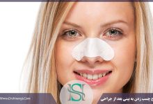 چسب بینی بعد از عمل