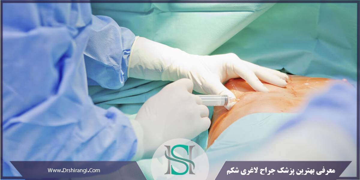 جراح خوب برای لاغری در تهران