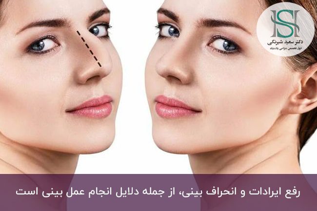 فرق بینی عروسکی با فانتزی چیست؟ | دکتر سعید شیرنگی