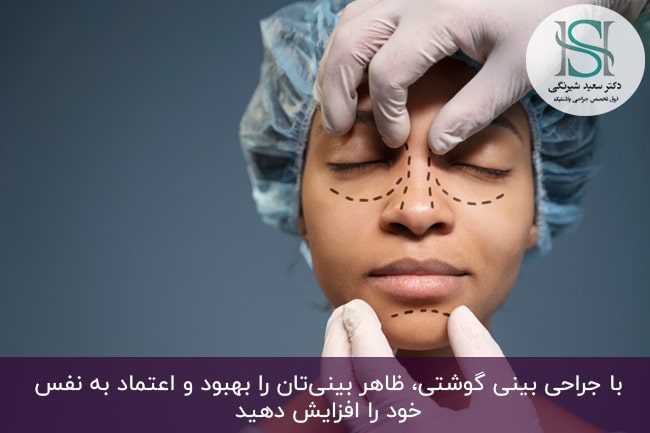 عمل بینی‌ گوشتی فانتزی