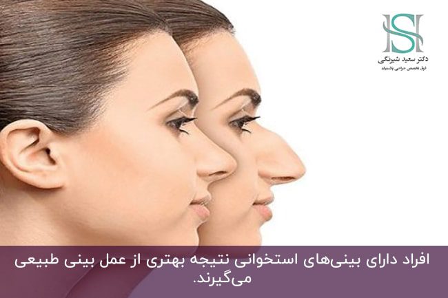 عمل بینی طبیعی چیست و چه شرایطی دارد؟ - دکتر سعید شیرنگی