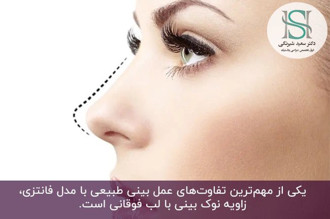 عمل بینی طبیعی چیست و چه شرایطی دارد؟ - دکتر سعید شیرنگی