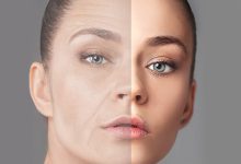 تزریق چربی به صورت