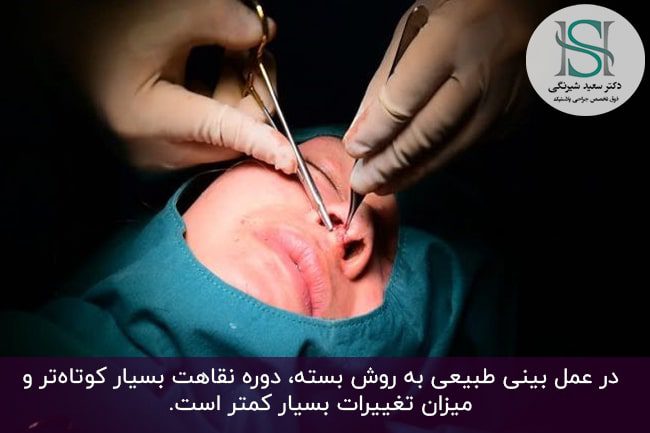 جراحی بینی به روش بسته