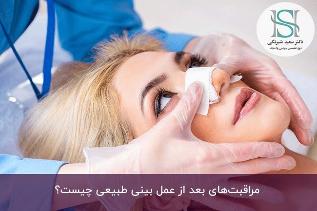 مراقبت‌های بعد از عمل بینی طبیعی