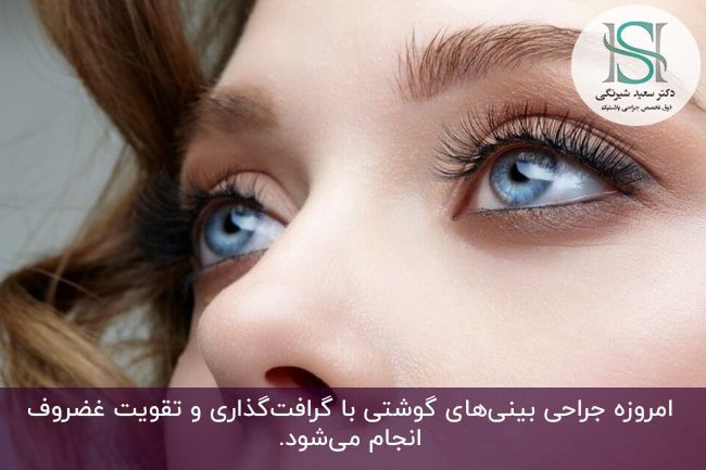 جراحی بینی گوشتی طبیعی