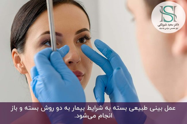 عمل‌ طبیعی‌ بینی‌